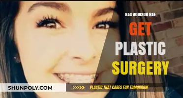 Addison Rae Plastic Surgery: Fact-Checking the Rumors and Speculations