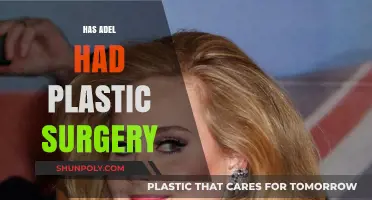 Has Adele Had Plastic Surgery? Uncovering the Truth Behind Her Transformation