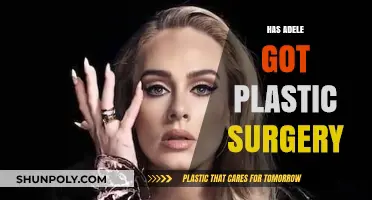 Adele's Transformation: Plastic Surgery Rumors and the Truth Behind Them