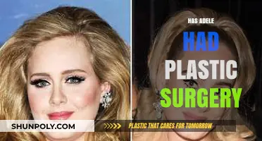 Adele's Transformation: Plastic Surgery Rumors and the Truth Behind Them