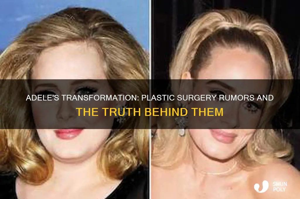 has adele had plastic surgery