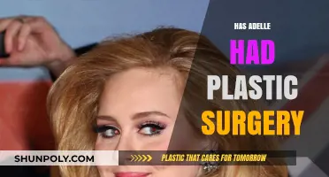 Has Adele Had Plastic Surgery? Uncovering the Truth Behind Her Transformation