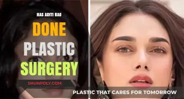 Aditi Rao Plastic Surgery: Fact-Checking the Rumors and Speculations