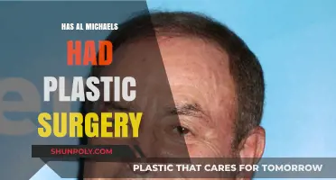 Al Michaels Plastic Surgery: Fact-Checking the Rumors and Speculations