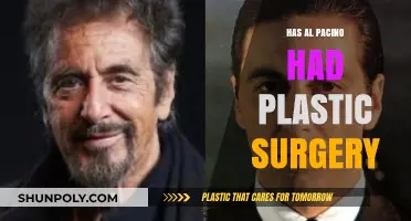 Al Pacino's Changing Looks: Plastic Surgery Rumors Explored