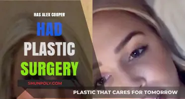 Alex Cooper's Transformation: Plastic Surgery Rumors Explored and Debunked
