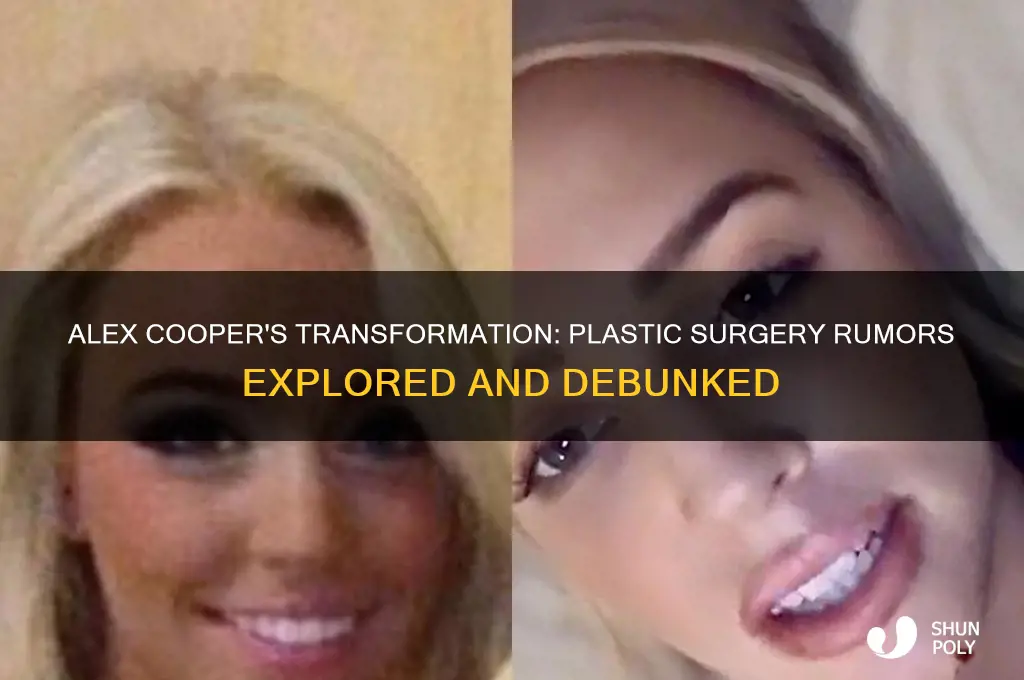has alex cooper had plastic surgery