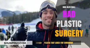 Alex Hall's Transformation: Plastic Surgery Rumors Explored and Debunked
