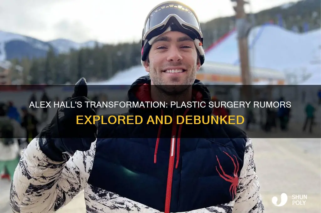 has alex hall had plastic surgery