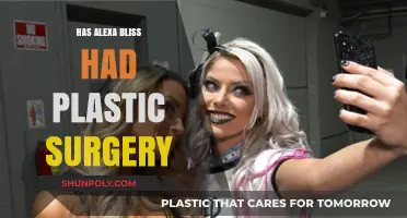 Alexa Bliss Plastic Surgery: Fact-Checking the WWE Star's Transformation