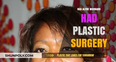 Alfre Woodard's Ageless Beauty: Plastic Surgery Speculations Explored