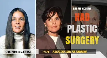 Has Ali MacGraw Had Plastic Surgery? Unveiling the Truth