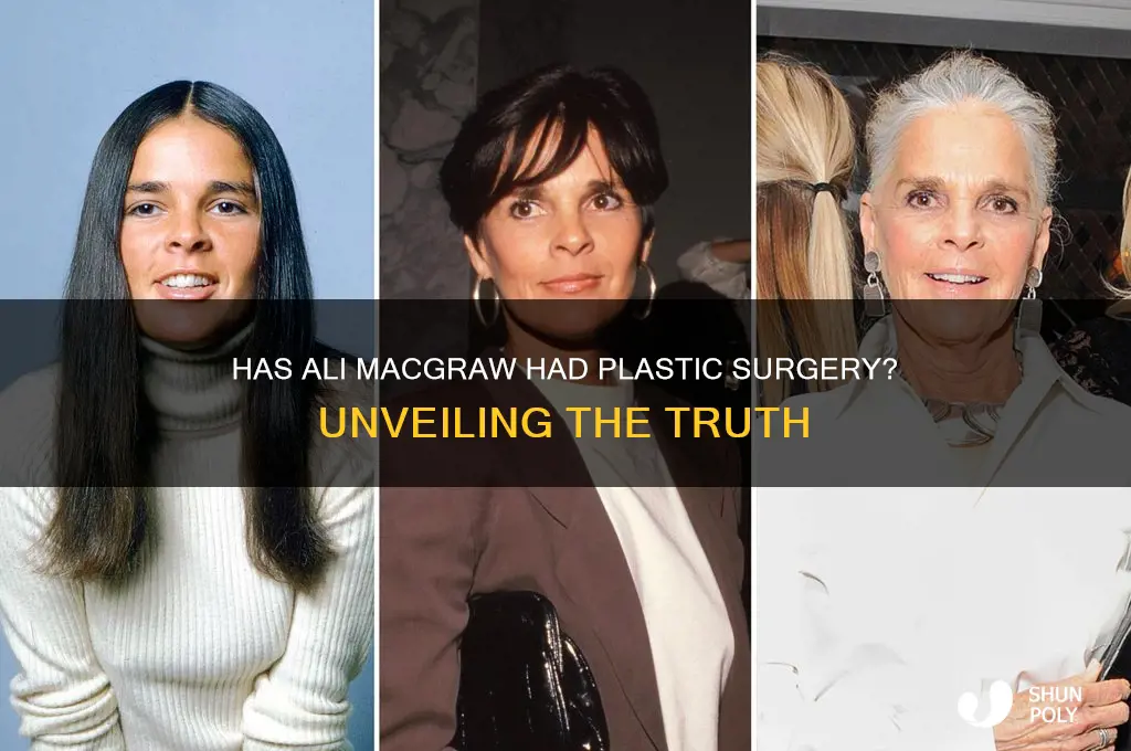 has ali mcgraw had plastic surgery