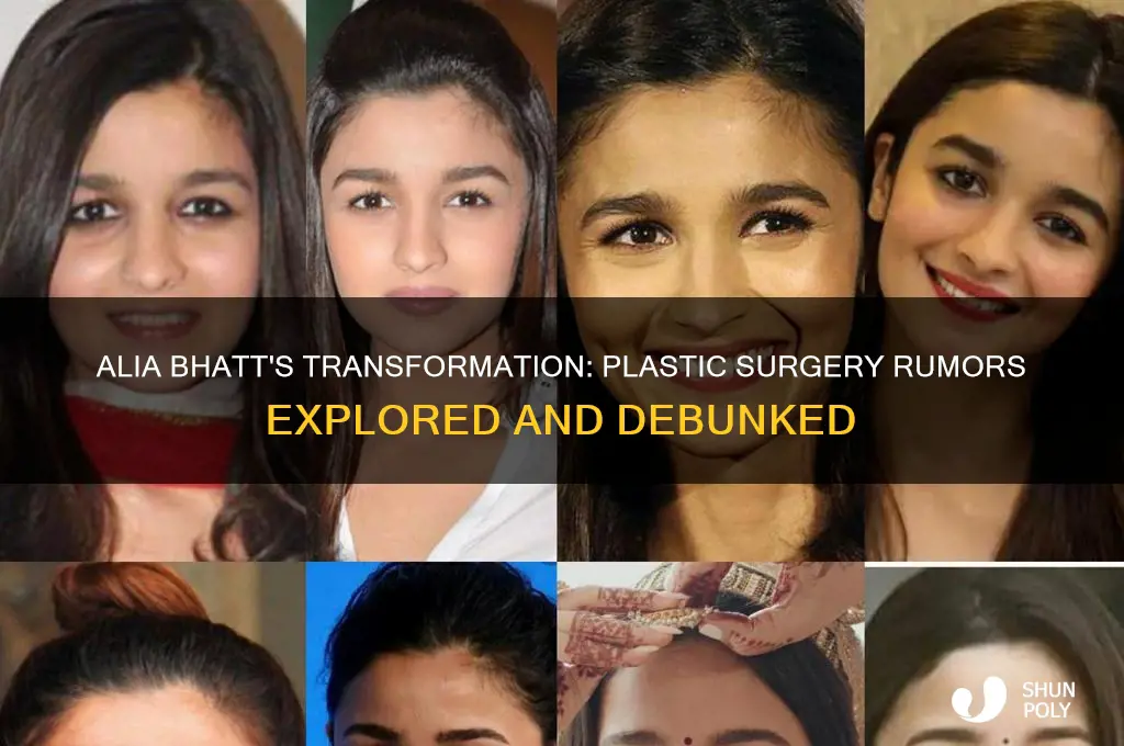 has alia bhatt done plastic surgery