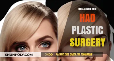 Alison Brie Plastic Surgery: Fact-Checking the Rumors and Speculations