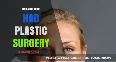 Allie Long's Transformation: Plastic Surgery Speculations and Truths Revealed