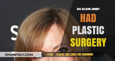 Allison Janney's Transformation: Plastic Surgery Speculations and Truths