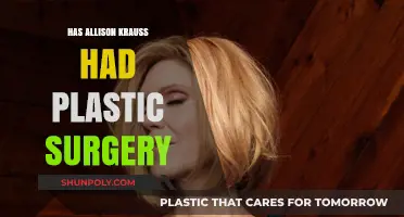 Allison Krauss Plastic Surgery: Fact or Fiction? Unveiling the Truth