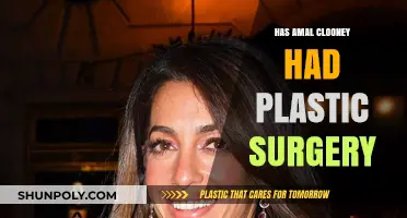 Amal Clooney's Transformation: Plastic Surgery Speculations and Truths