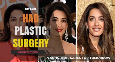 Has Amal Clooney Undergone Plastic Surgery? Unveiling the Truth