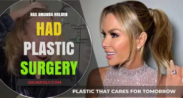 Amanda Holden's Transformation: Plastic Surgery Rumors Explored and Debunked