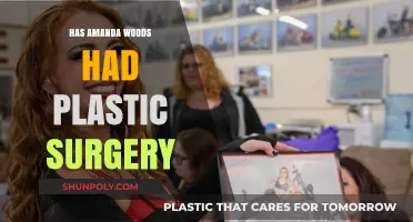 Amanda Woods Plastic Surgery: Fact-Checking Rumors and Speculations