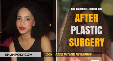 Amber Gill's Transformation: Plastic Surgery Before and After Revealed