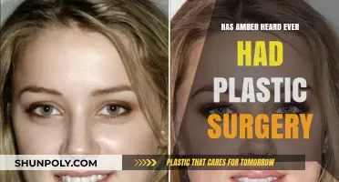 Amber Heard's Transformation: Plastic Surgery Speculations and Rumors Explored