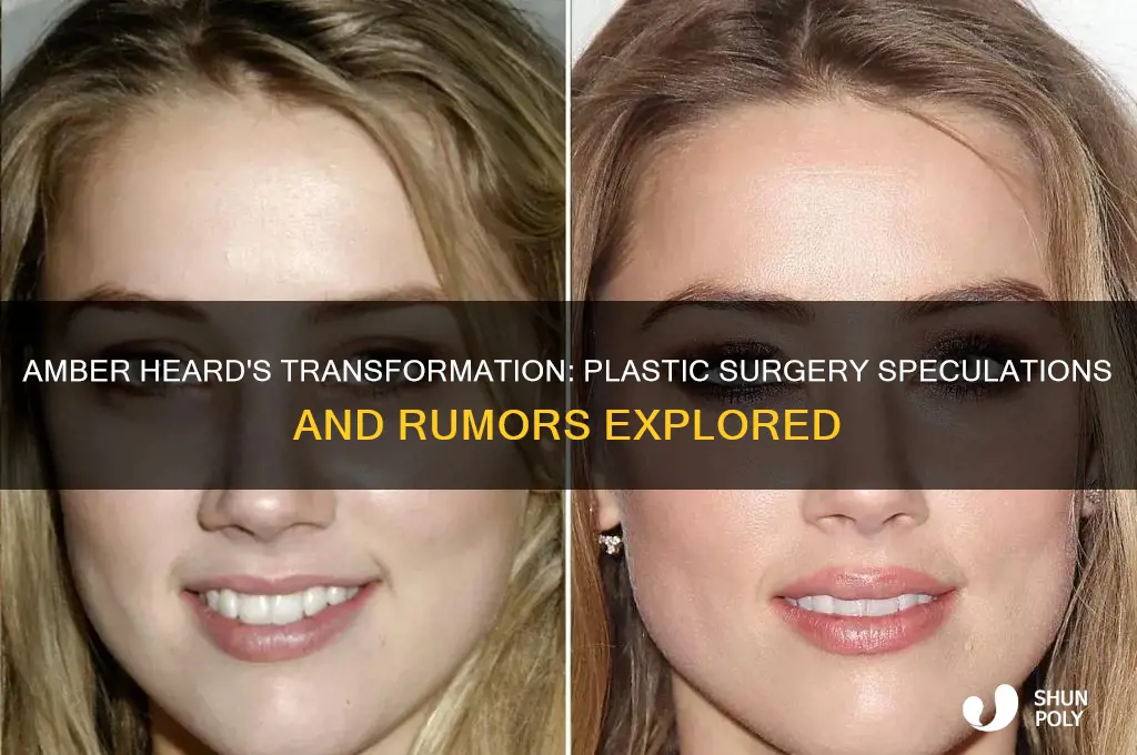 has amber heard ever had plastic surgery