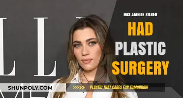 Amelie Zilber Plastic Surgery: Fact-Checking the Rumors and Speculations