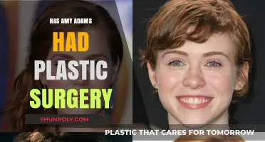 Amy Adams Plastic Surgery: Fact-Checking the Rumors and Speculations