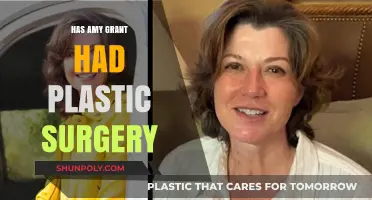 Amy Grant's Transformation: Plastic Surgery Speculations and Truths Revealed