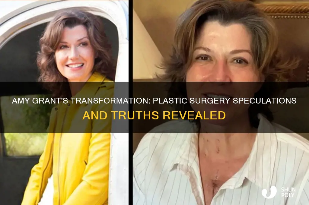 has amy grant had plastic surgery