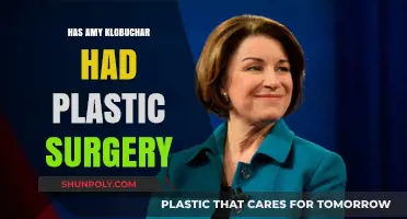 Amy Klobuchar Plastic Surgery: Fact-Checking the Rumors and Speculations