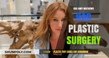 Amy Mathews Plastic Surgery: Fact-Checking the Rumors and Speculations