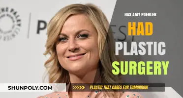 Amy Poehler Plastic Surgery: Fact-Checking Rumors and Speculations