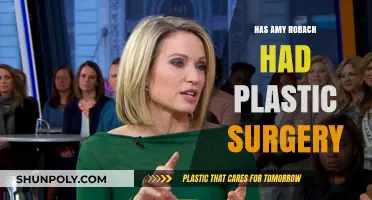 Amy Robach's Transformation: Plastic Surgery Speculations and Truths Revealed