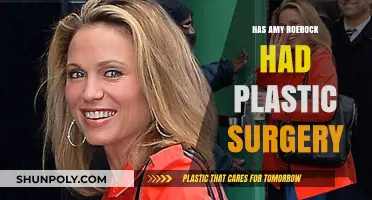 Amy Roebuck Plastic Surgery: Fact-Checking the Rumors and Speculations