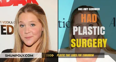 Amy Schumer's Transformation: Plastic Surgery Rumors and Reality Explored