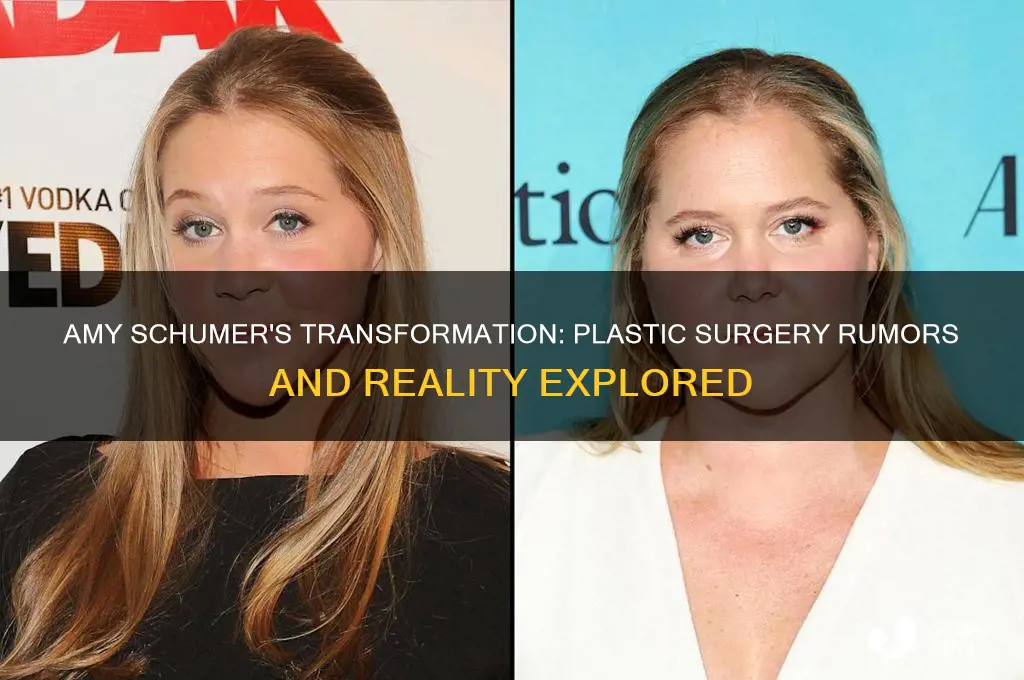 has amy schumer had plastic surgery