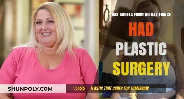 Angela's Transformation: Plastic Surgery Speculations on 90 Day Fiancé Star