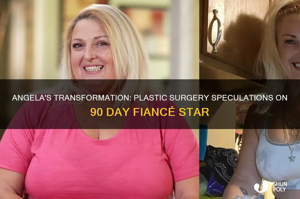 has angela from 90 day fiance had plastic surgery