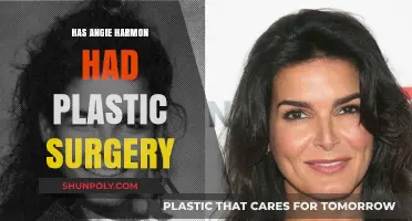Angie Harmon's Transformation: Plastic Surgery Speculations and Truths Revealed