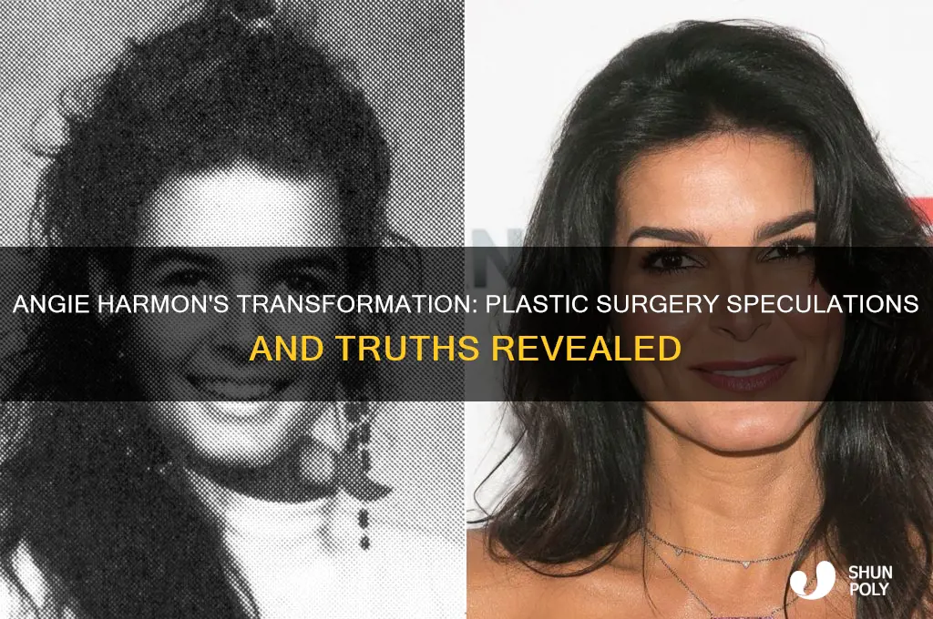 has angie harmon had plastic surgery