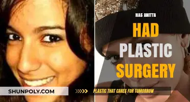 Anitta's Transformation: Unveiling the Truth About Her Plastic Surgery Rumors