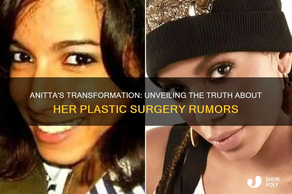 has anitta had plastic surgery