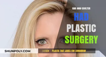 Ann Coulter's Transformation: Plastic Surgery Speculations and Truths Revealed
