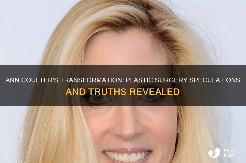 has ann coulter had plastic surgery