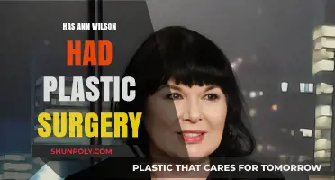 Ann Wilson's Transformation: Plastic Surgery Speculations and Truths