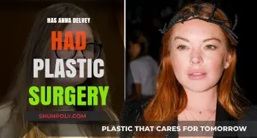 Anna Delvey's Transformation: Plastic Surgery Speculations and Truths Revealed